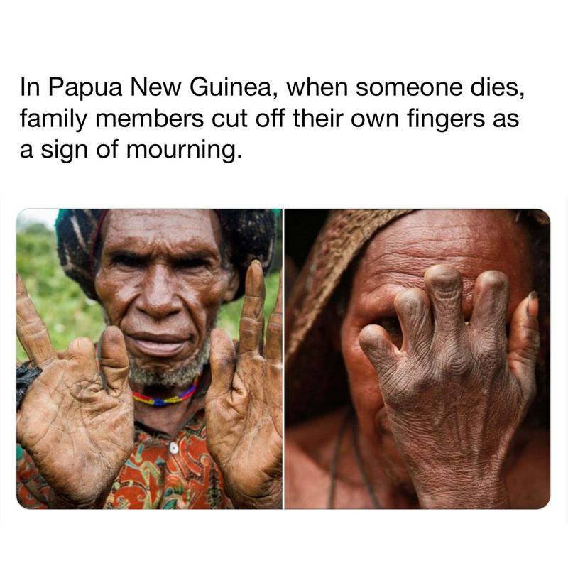 Finger Cutting in Papua New Guinea